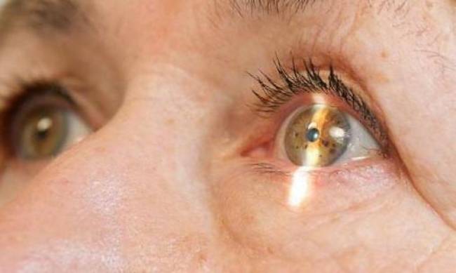 Лечение катаракты в Киеве: особенности болезни фото