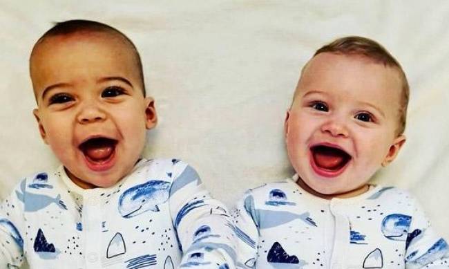 W Polsce urodziły się bliźnięta o różnych kolorach skóry – to medyczna przypadłość фото