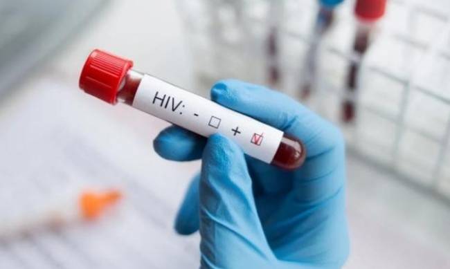 Polska odnotowuje rekordowy wzrost zachorowań na HIV фото